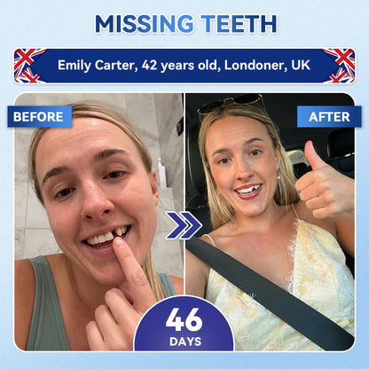 𝐍𝐇𝐒 𝐑𝐞𝐠𝐢𝐬𝐭𝐞𝐫𝐞𝐝 & 𝐆𝐌𝐏 𝐂𝐞𝐫𝐭𝐢𝐟𝐢𝐞𝐝🔗|𝐆𝐥𝐢𝐦𝐦𝐞𝐫𝐥𝐲® 𝐓𝐢𝐝𝐞𝐠𝐥𝐮𝐬𝐢𝐛 𝐓𝐨𝐨𝐭𝐡 & 𝐆𝐮𝐦 𝐑𝐞𝐩𝐚𝐢𝐫 𝐌𝐢𝐜𝐫𝐨𝐧𝐞𝐞𝐝𝐥𝐞 𝐏𝐚𝐭𝐜𝐡|✅𝐀𝐝𝐯𝐚𝐧𝐜𝐞𝐝 𝐒𝐭𝐞𝐦-𝐂𝐞𝐥𝐥 𝐀𝐜𝐭𝐢𝐯𝐚𝐭𝐢𝐨𝐧 𝐓𝐞𝐞𝐭𝐡 𝐒𝐭𝐫𝐢𝐩𝐬(𝐑𝐞𝐛𝐮𝐢𝐥𝐝 𝐄𝐧𝐚𝐦𝐞𝐥 & 𝐃𝐞𝐧𝐭𝐢𝐧 • 𝐒𝐭𝐫𝐞𝐧𝐠𝐭𝐡𝐞𝐧 𝐆𝐮𝐦𝐬 • 𝐄𝐫𝐚𝐝𝐢𝐜𝐚𝐭𝐞 𝐓𝐚𝐫𝐭𝐚𝐫 & 𝐎𝐝𝐨𝐫 • 𝐒𝐭𝐨𝐩 𝐓𝐨𝐨𝐭𝐡 𝐒𝐞𝐧𝐬𝐢𝐭𝐢𝐯𝐢𝐭𝐲)