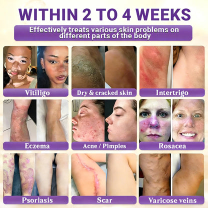 𝑶𝒇𝒇𝒊𝒄𝒊𝒂𝒍 𝑺𝒕𝒐𝒓𝒆 | 👩‍⚕️ 𝑾𝑹𝑬𝑬® 𝑩𝒊𝒐𝒕𝒊𝒏 & 𝑻𝒂𝒍𝒍𝒐𝒘 10-𝑰𝑵-1 𝑨𝒅𝒗𝒂𝒏𝒄𝒆𝒅 𝑹𝒆𝒔𝒕𝒐𝒓𝒂𝒕𝒊𝒐𝒏 𝑪𝒓𝒆𝒂𝒎 (𝐎𝐧𝐜𝐞 𝐃𝐚𝐢𝐥𝐲, 𝐯𝐢𝐬𝐢𝐛𝐥𝐞 𝐜𝐡𝐚𝐧𝐠𝐞𝐬 𝐢𝐧 𝟕 𝐝𝐚𝐲𝐬）✅ 𝑷𝒖𝒓𝒑𝒖𝒓𝒂, 𝑨𝒈𝒆 𝑺𝒑𝒐𝒕𝒔, 𝑾𝒓𝒊𝒏𝒌𝒍𝒆𝒔, 𝑨𝒏𝒅 𝑺𝒌𝒊𝒏 𝑻𝒂𝒈𝒔💎