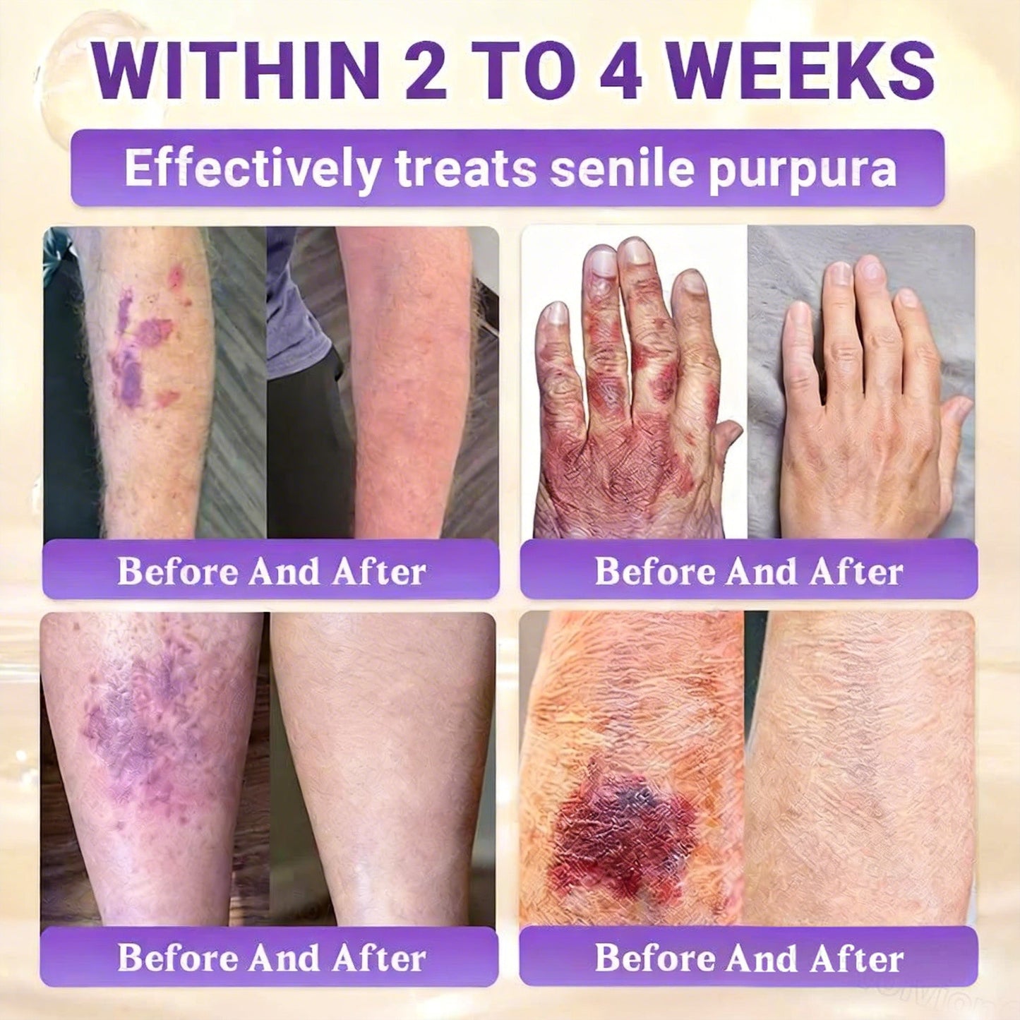 𝑶𝒇𝒇𝒊𝒄𝒊𝒂𝒍 𝑺𝒕𝒐𝒓𝒆 | 👩‍⚕️ 𝑾𝑹𝑬𝑬® 𝑩𝒊𝒐𝒕𝒊𝒏 & 𝑻𝒂𝒍𝒍𝒐𝒘 10-𝑰𝑵-1 𝑨𝒅𝒗𝒂𝒏𝒄𝒆𝒅 𝑹𝒆𝒔𝒕𝒐𝒓𝒂𝒕𝒊𝒐𝒏 𝑪𝒓𝒆𝒂𝒎 (𝐎𝐧𝐜𝐞 𝐃𝐚𝐢𝐥𝐲, 𝐯𝐢𝐬𝐢𝐛𝐥𝐞 𝐜𝐡𝐚𝐧𝐠𝐞𝐬 𝐢𝐧 𝟕 𝐝𝐚𝐲𝐬）✅ 𝑷𝒖𝒓𝒑𝒖𝒓𝒂, 𝑨𝒈𝒆 𝑺𝒑𝒐𝒕𝒔, 𝑾𝒓𝒊𝒏𝒌𝒍𝒆𝒔, 𝑨𝒏𝒅 𝑺𝒌𝒊𝒏 𝑻𝒂𝒈𝒔💎