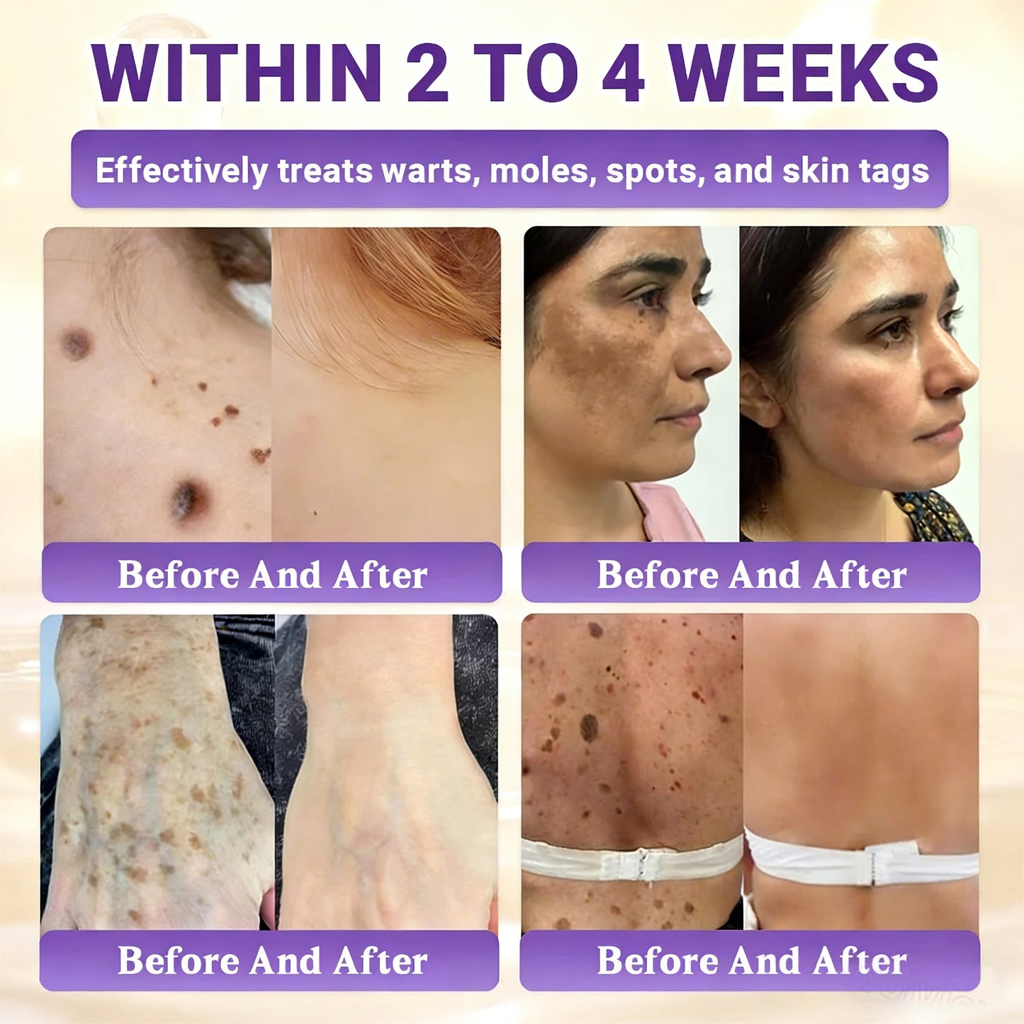𝑶𝒇𝒇𝒊𝒄𝒊𝒂𝒍 𝑺𝒕𝒐𝒓𝒆 | 👩‍⚕️ 𝑾𝑹𝑬𝑬® 𝑩𝒊𝒐𝒕𝒊𝒏 & 𝑻𝒂𝒍𝒍𝒐𝒘 10-𝑰𝑵-1 𝑨𝒅𝒗𝒂𝒏𝒄𝒆𝒅 𝑹𝒆𝒔𝒕𝒐𝒓𝒂𝒕𝒊𝒐𝒏 𝑪𝒓𝒆𝒂𝒎 (𝐎𝐧𝐜𝐞 𝐃𝐚𝐢𝐥𝐲, 𝐯𝐢𝐬𝐢𝐛𝐥𝐞 𝐜𝐡𝐚𝐧𝐠𝐞𝐬 𝐢𝐧 𝟕 𝐝𝐚𝐲𝐬）✅ 𝑷𝒖𝒓𝒑𝒖𝒓𝒂, 𝑨𝒈𝒆 𝑺𝒑𝒐𝒕𝒔, 𝑾𝒓𝒊𝒏𝒌𝒍𝒆𝒔, 𝑨𝒏𝒅 𝑺𝒌𝒊𝒏 𝑻𝒂𝒈𝒔💎