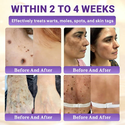 𝑶𝒇𝒇𝒊𝒄𝒊𝒂𝒍 𝑺𝒕𝒐𝒓𝒆 | 👩‍⚕️ 𝑾𝑹𝑬𝑬® 𝑩𝒊𝒐𝒕𝒊𝒏 & 𝑻𝒂𝒍𝒍𝒐𝒘 10-𝑰𝑵-1 𝑨𝒅𝒗𝒂𝒏𝒄𝒆𝒅 𝑹𝒆𝒔𝒕𝒐𝒓𝒂𝒕𝒊𝒐𝒏 𝑪𝒓𝒆𝒂𝒎 (𝐎𝐧𝐜𝐞 𝐃𝐚𝐢𝐥𝐲, 𝐯𝐢𝐬𝐢𝐛𝐥𝐞 𝐜𝐡𝐚𝐧𝐠𝐞𝐬 𝐢𝐧 𝟕 𝐝𝐚𝐲𝐬）✅ 𝑷𝒖𝒓𝒑𝒖𝒓𝒂, 𝑨𝒈𝒆 𝑺𝒑𝒐𝒕𝒔, 𝑾𝒓𝒊𝒏𝒌𝒍𝒆𝒔, 𝑨𝒏𝒅 𝑺𝒌𝒊𝒏 𝑻𝒂𝒈𝒔💎