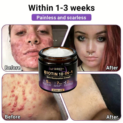 𝑶𝒇𝒇𝒊𝒄𝒊𝒂𝒍 𝑺𝒕𝒐𝒓𝒆 | 👩‍⚕️ 𝑾𝑹𝑬𝑬® 𝑩𝒊𝒐𝒕𝒊𝒏 & 𝑻𝒂𝒍𝒍𝒐𝒘 10-𝑰𝑵-1 𝑨𝒅𝒗𝒂𝒏𝒄𝒆𝒅 𝑹𝒆𝒔𝒕𝒐𝒓𝒂𝒕𝒊𝒐𝒏 𝑪𝒓𝒆𝒂𝒎 (𝐎𝐧𝐜𝐞 𝐃𝐚𝐢𝐥𝐲, 𝐯𝐢𝐬𝐢𝐛𝐥𝐞 𝐜𝐡𝐚𝐧𝐠𝐞𝐬 𝐢𝐧 𝟕 𝐝𝐚𝐲𝐬）✅ 𝑷𝒖𝒓𝒑𝒖𝒓𝒂, 𝑨𝒈𝒆 𝑺𝒑𝒐𝒕𝒔, 𝑾𝒓𝒊𝒏𝒌𝒍𝒆𝒔, 𝑨𝒏𝒅 𝑺𝒌𝒊𝒏 𝑻𝒂𝒈𝒔💎