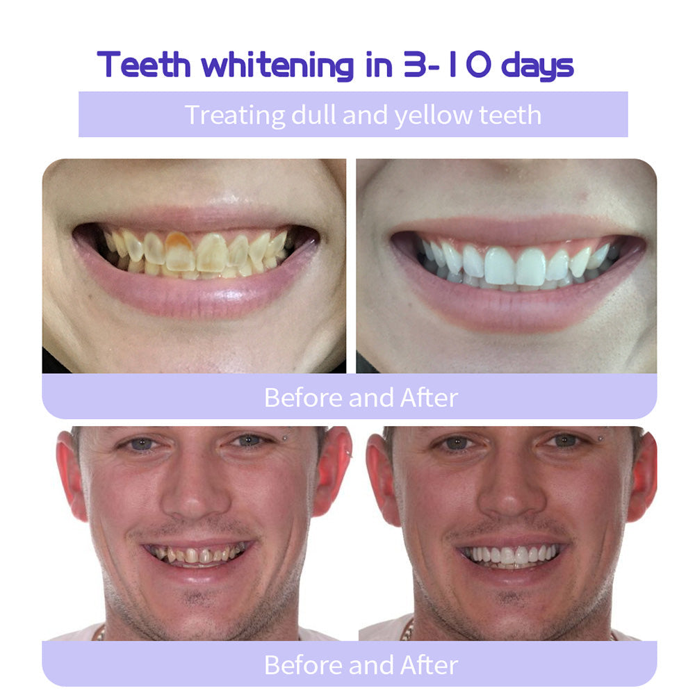 𝐎𝐲𝐢𝐤𝐞𝐲® 𝐓𝐞𝐞𝐭𝐡 𝐑𝐞𝐬𝐭𝐨𝐫𝐚𝐭𝐢𝐨𝐧 𝐌𝐢𝐧𝐞𝐫𝐚𝐥 𝐏𝐨𝐰𝐝𝐞𝐫 👩‍⚕️(🔥🔥𝑳𝒂𝒔𝒕 𝒅𝒂𝒚 𝒑𝒓𝒐𝒎𝒐𝒕𝒊𝒐𝒏 𝟕𝟓% 𝒐𝒇𝒇🔥🔥)🛡️