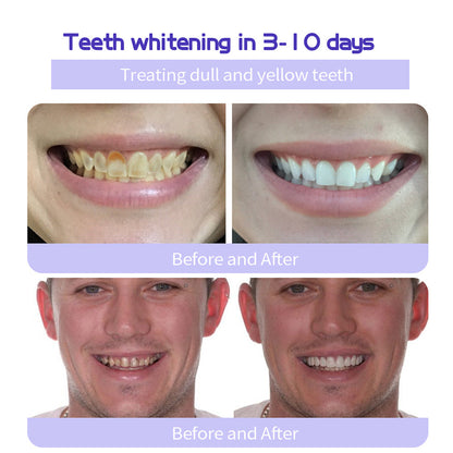 𝐎𝐲𝐢𝐤𝐞𝐲® 𝐓𝐞𝐞𝐭𝐡 𝐑𝐞𝐬𝐭𝐨𝐫𝐚𝐭𝐢𝐨𝐧 𝐌𝐢𝐧𝐞𝐫𝐚𝐥 𝐏𝐨𝐰𝐝𝐞𝐫 👩‍⚕️(🔥🔥𝑳𝒂𝒔𝒕 𝒅𝒂𝒚 𝒑𝒓𝒐𝒎𝒐𝒕𝒊𝒐𝒏 𝟕𝟓% 𝒐𝒇𝒇🔥🔥)🛡️