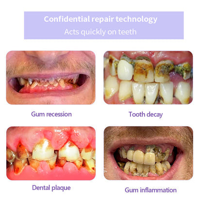 𝐎𝐲𝐢𝐤𝐞𝐲® 𝐓𝐞𝐞𝐭𝐡 𝐑𝐞𝐬𝐭𝐨𝐫𝐚𝐭𝐢𝐨𝐧 𝐌𝐢𝐧𝐞𝐫𝐚𝐥 𝐏𝐨𝐰𝐝𝐞𝐫 👩‍⚕️(🔥🔥𝑳𝒂𝒔𝒕 𝒅𝒂𝒚 𝒑𝒓𝒐𝒎𝒐𝒕𝒊𝒐𝒏 𝟕𝟓% 𝒐𝒇𝒇🔥🔥)🛡️